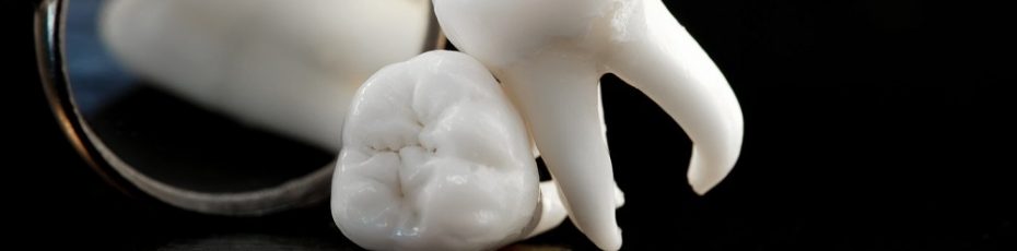 tooth extractions in West Roxbury
