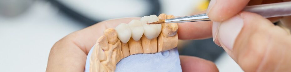 dental bridges wax sample