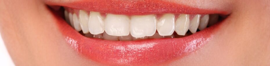 smiling face after teeth whitening