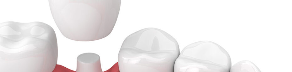 3D dental crown image