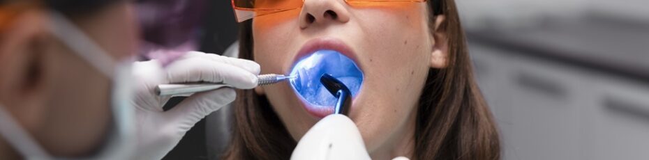 Whitening Treatment - Nine One Dental