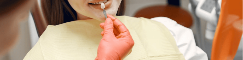 How Long Do Dental Sealants Last Tips for Longevity