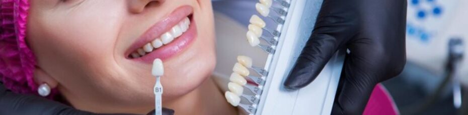 porcelain veneers