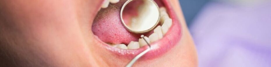 Dental Bridges Near You