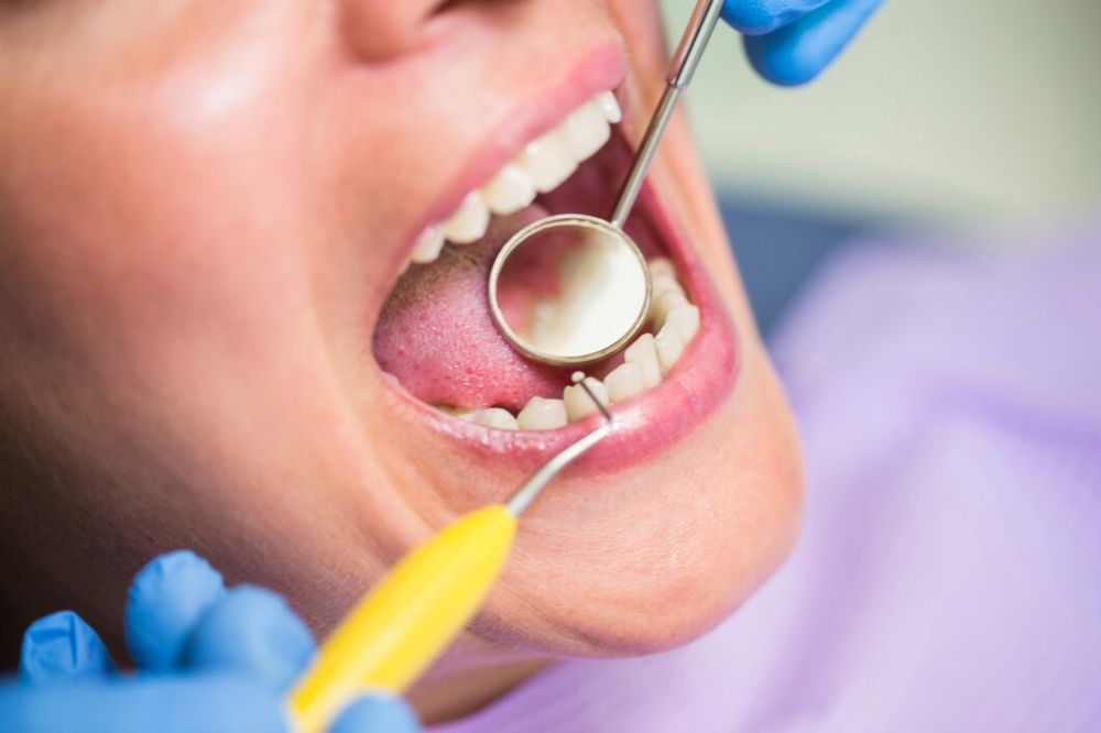 Dental Bridges Near You